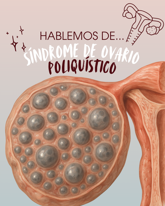 El Síndrome de Ovario Poliquístico: lo que nadie explica con claridad
